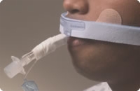 Dale Endotracheal Stabilock Holder