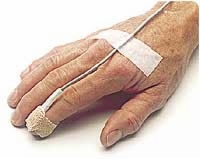 Pulse Oximeter Adult/neonatal Sensor