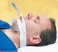 Trachtape, Endotracheal Tube Securing Device