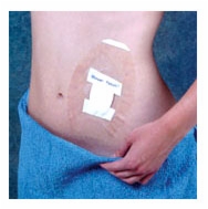 Shower Patch/Seal Tight Pk/5