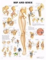 Hip & Knee Chart 26  X 20