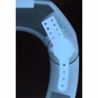 Hinge X-Ray